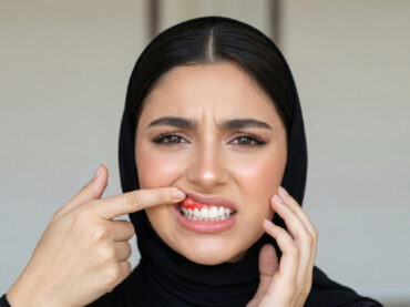 جراحة اللثة